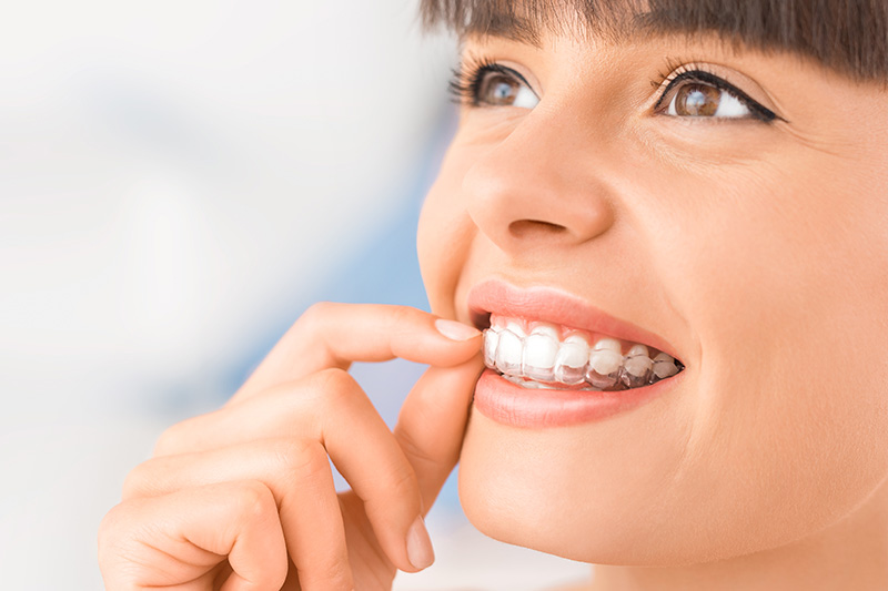 Clear Correct Clear Ortho Aligners in San Marcos