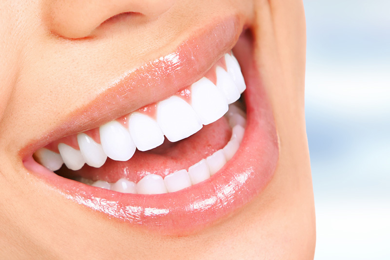 Cosmetic Dentistry in San Marcos